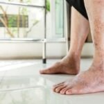 Diabetic Foot